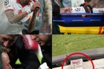 手指幸运保住！TA：诺阿&middot;朗的大拇指不用截肢，但伤势严重